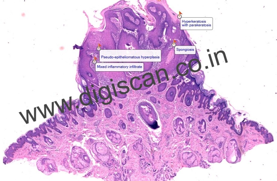 Dermatopathology Quiz Cases (Digital Slides for PG Exam & Self-Assessment)
